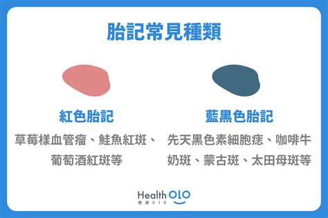 咖啡色胎記|胎記怎麼產生、何時消除？醫師剖析胎記種類、胎記寓意